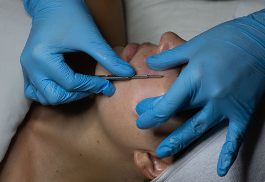 FULL FACE DERMAPLANING